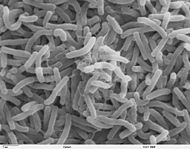 Cholera bacteria SEM.jpg